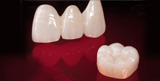 carolina dental ceramics crowns and bridges